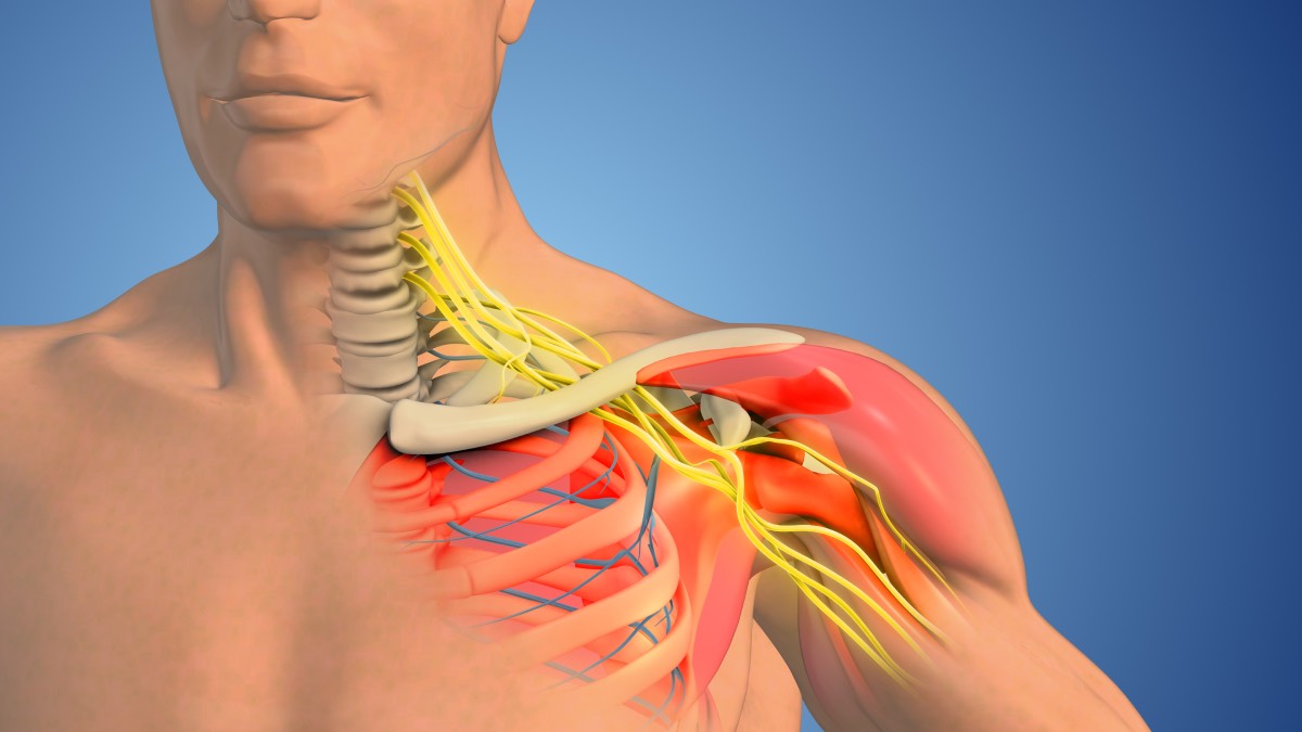 Bupivacaine vs. Ropivacaine for Interscalene Block