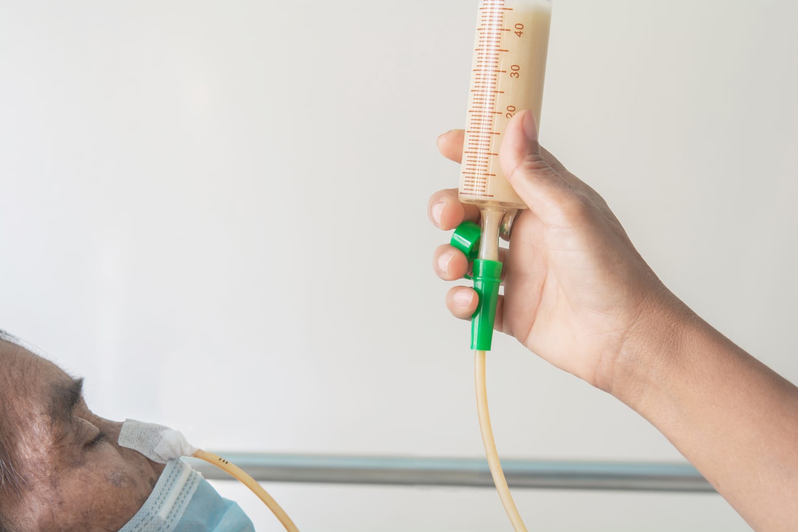 Nutritional Support in the Critical Care Setting