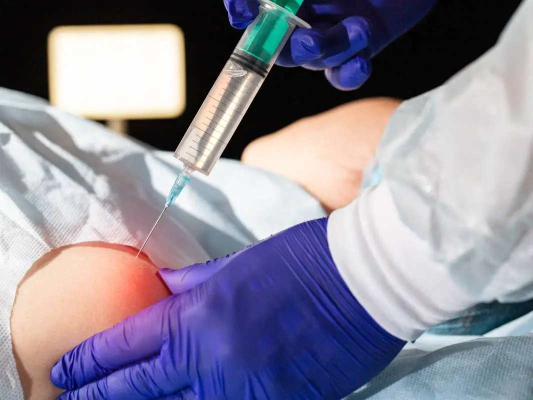Regional Anesthesia for Orthopedic Surgery in Upper Extremities